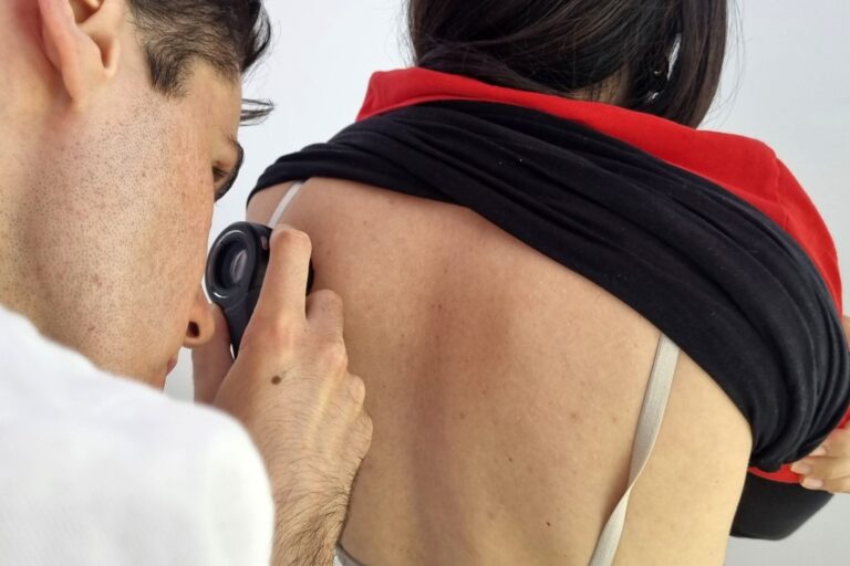 OTKAZUJU SE besplatni dermatološki pregledi zbog najave lošeg vremena