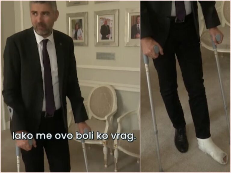 Franković ozlijedio nogu dok je kosio travu, kaže da ga jednako boli kao i nepravedni sustav oporezivanja privatnog smještaja