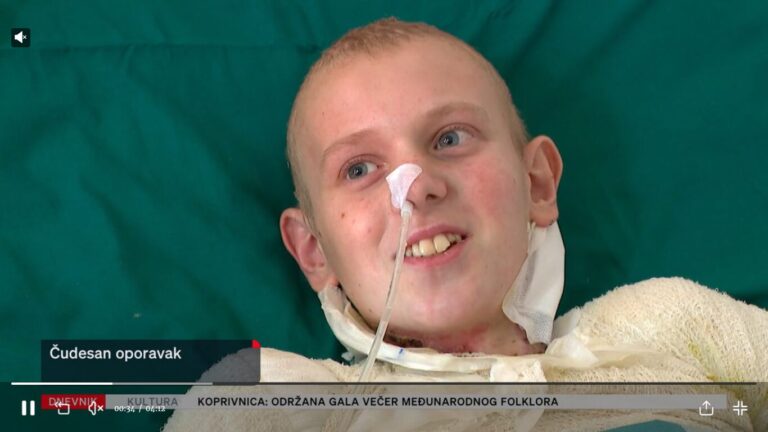 Petnaestogodišnji Roko koji je na Osojniku stradao od strujnog udara čudesno se oporavlja. Pravi je junak, kažu liječnici
